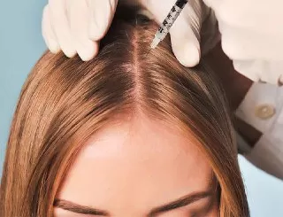 mesotherapy-for-hair