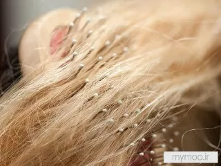 چگونه فولیکول موهایتان را تحریک کنید